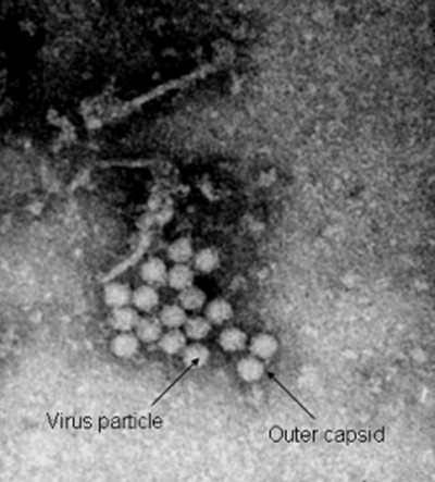 Porcine circovirus type 2 (PCV2) with fine outer capsid