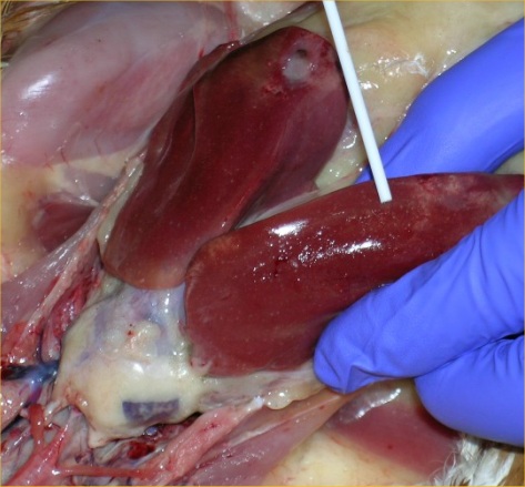 Avian Vibrionic Hepatitis - Avian infectious hepatitis - Swollen liver with white to grey focal lesions and perihepatitis